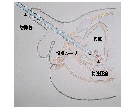 oma1111.gif