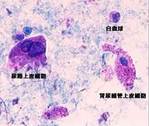 一般検査